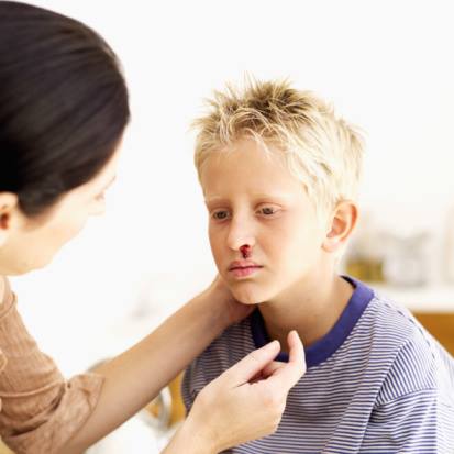 CentaurUK's tweet image. #FirstAid tip
If someone is suffering with a nose bleed advise them to tip their head forward while nipping the soft part of the nose and maintain constant pressure for 10 minutes.
#firstaid #nosebleed #firstaidadvice