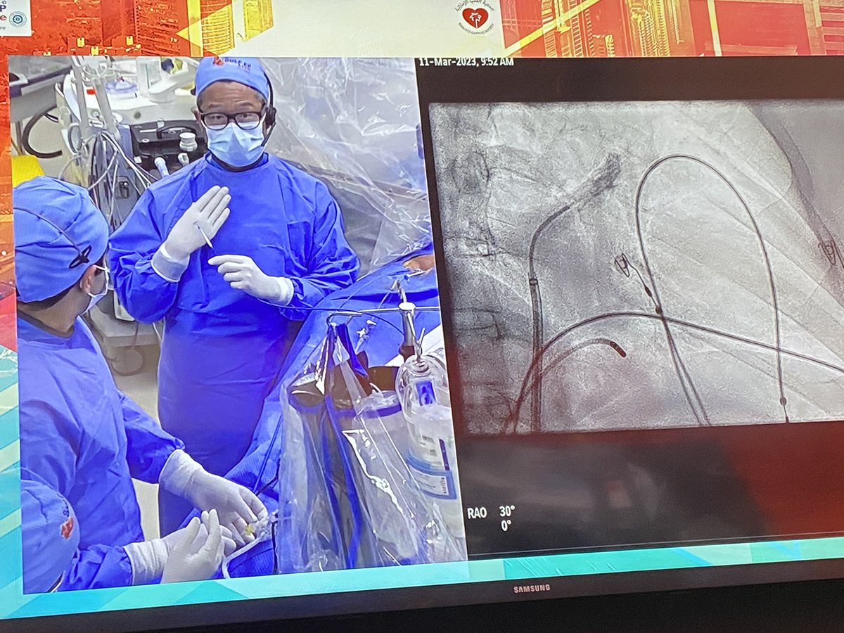 RolandTilz's tweet photo. Day one of #GulfEP in #Dubai with a great faculty! Starting with a great live Cryo balloon case from @jongichun
@ChristianHeeger @UKSH_KI_HL @AGEP_DGK @KardiologieHH @Phiso_de @giuliavogler #innovation @Dominik_Linz https://t.co/Lbgr4ln8ij