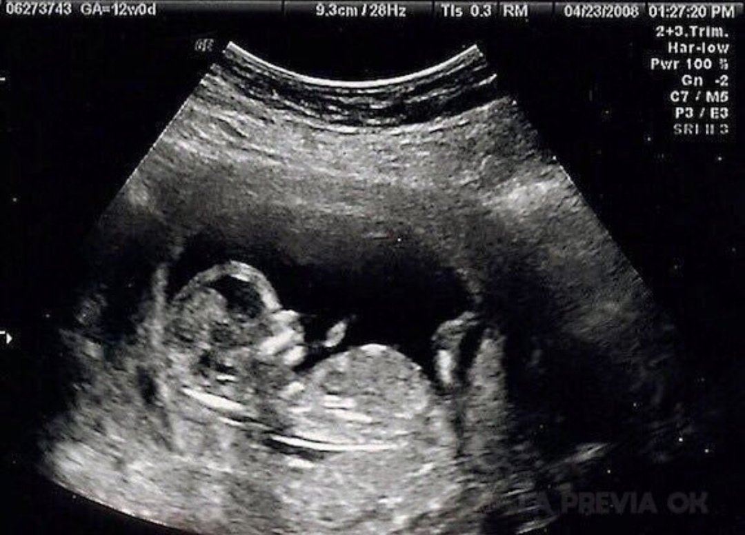 una foto de la última vez que dormí bien