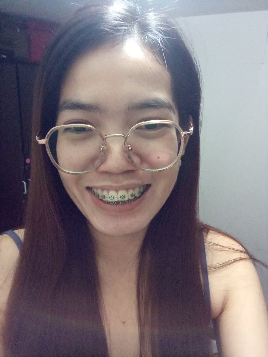 Rolieme22's tweet image. 91st day of braces 😁

#overbite