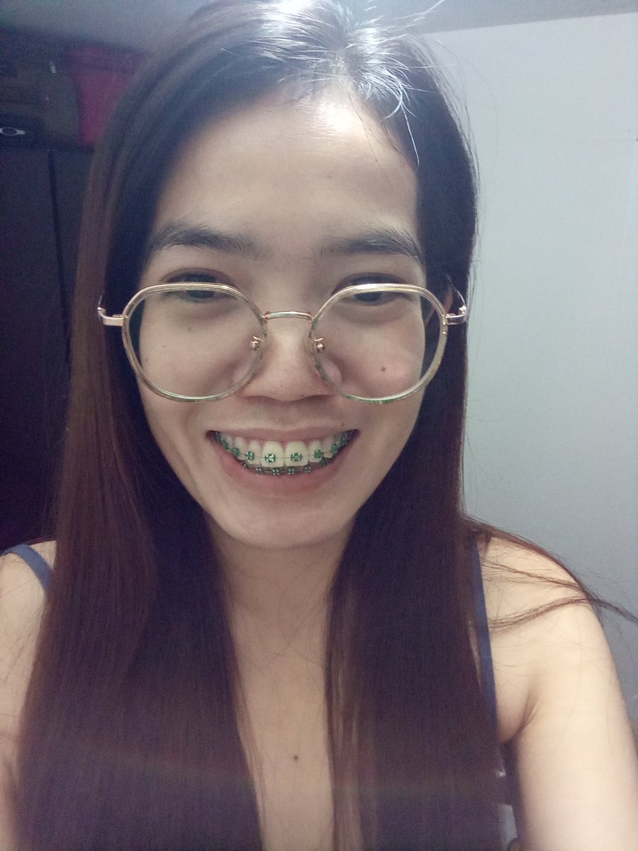 Rolieme22's tweet image. 91st day of braces 😁

#overbite