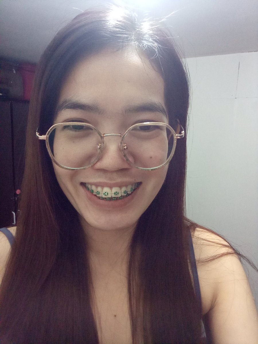 Rolieme22's tweet image. 91st day of braces 😁

#overbite