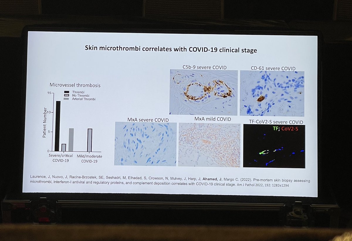 MaryCushmanMD's tweet image. Super cool. Skin biopsy microthrombi and immune changes correlate with disease severity in #COVID19 #HTRS2023