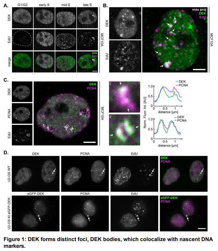 MachPierzynska's tweet photo. Excited to share our latest preprint from @DiasproLab, @ferrandoelisa, and Ferdinand Kappes, where we identified previously unknown heterochromatin replication DEK bodies! 
https://t.co/tf1SvHANsU 
@AD1959 @MSCActions @IITalk #oncoprotein #DNAreplication #epigenetics #imaging https://t.co/Q8TuaUngO3