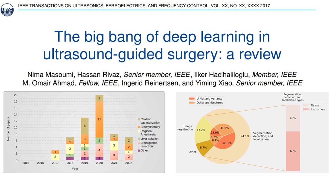 ilkhch (@ilkhch) on Twitter photo New review paper 'The big bang of deep learning in #ultrasound-guided #surgery: a review'. Graduate students usually do all the hard work, so special thanks to <a href="/Nimamousav_i/">Nima Mousavi</a>
and excellent PIs <a href="/HassanRivaz/">Hassan Rivaz</a> Omair Ahmad <a href="/ingerid_r/">Ingerid Reinertsen</a> <a href="/xiaobird/">Xiao</a>
Pre-print: ieeexplore.ieee.org/document/10065… New review paper 'The big bang of deep learning in #ultrasound-guided #surgery: a review'. Graduate students usually do all the hard work, so special thanks to <a href="/Nimamousav_i/">Nima Mousavi</a>
and excellent PIs <a href="/HassanRivaz/">Hassan Rivaz</a> Omair Ahmad <a href="/ingerid_r/">Ingerid Reinertsen</a> <a href="/xiaobird/">Xiao</a>
Pre-print: ieeexplore.ieee.org/document/10065…