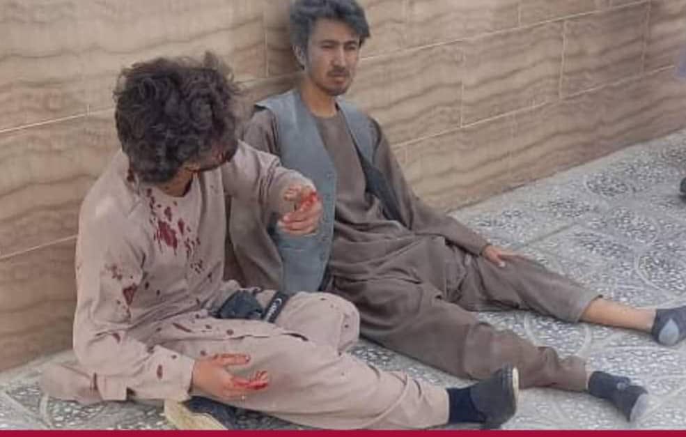 PressClubAF's tweet photo. KPC: Calls for International Investigation into Attack on Journalists in Balkh Province. Click for more https://t.co/TWYPQrwrLx https://t.co/hmQsZiJnEU