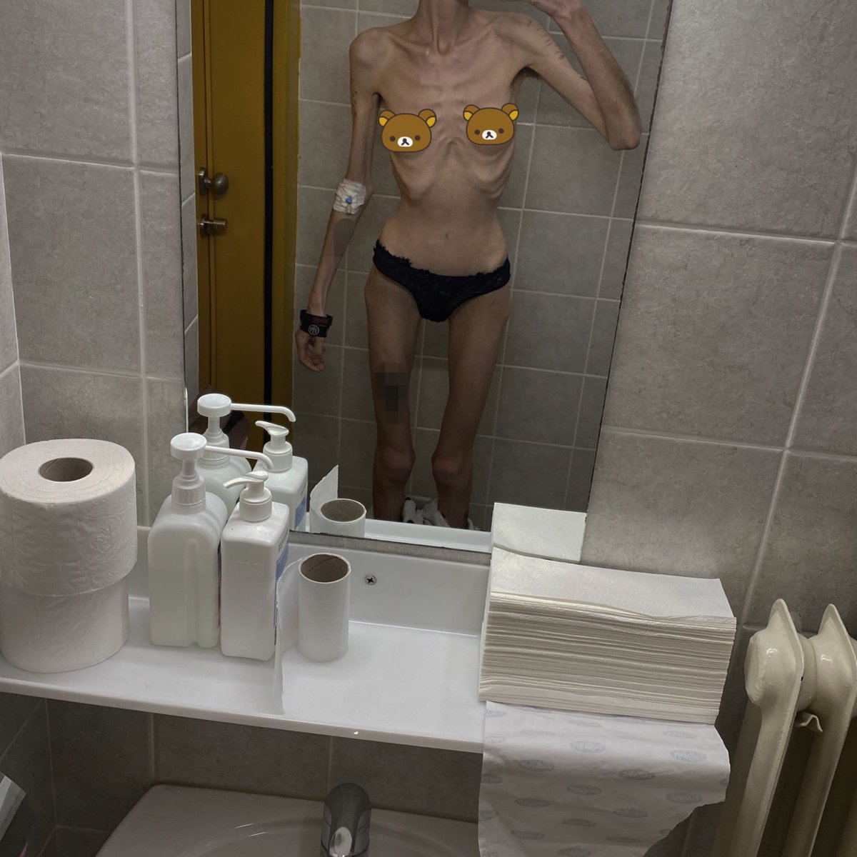 fr4gi1eb0n3s's tweet image. bodycheck !! m bmi 12.8 rn ??
✭ 
✭ 
✭ 
✭ 
✭