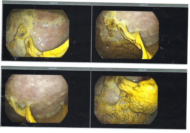 LISA THOMPSON tweet media