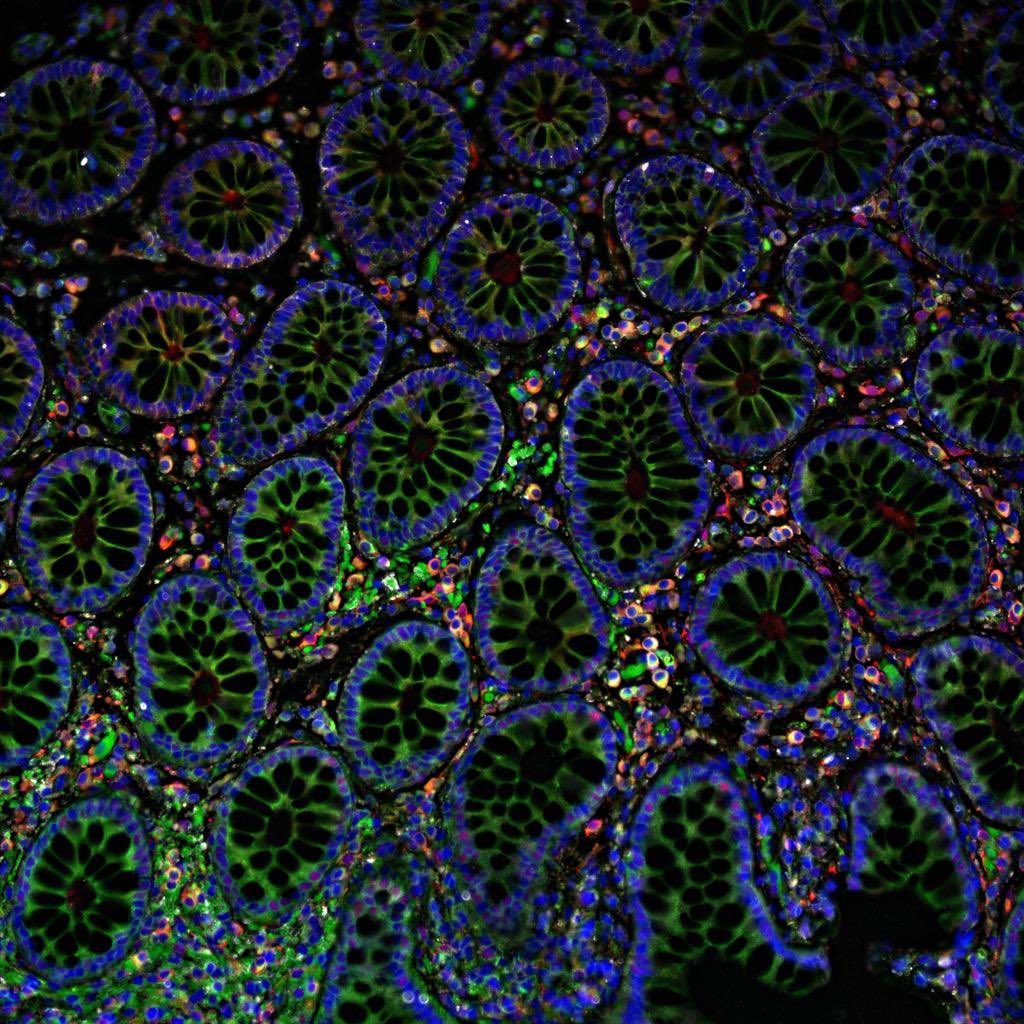Mack (@mack_bolen1) on Twitter photo A picture of a colon? At an art show? Heck yes!! Ecstatic to get to share my science in a unique way at UFโs Celebration of Research ๐ฉ๐ผโ๐ฌ๐<a href="/UFNeuroscience/">University of Florida Department of Neuroscience</a> <a href="/UFBioMed/">UF Biomed Sciences</a> Huge thank you to my amazing lab family and mentor @MaluTansey for making Bolenโs colons possible!! A picture of a colon? At an art show? Heck yes!! Ecstatic to get to share my science in a unique way at UFโs Celebration of Research ๐ฉ๐ผโ๐ฌ๐<a href="/UFNeuroscience/">University of Florida Department of Neuroscience</a> <a href="/UFBioMed/">UF Biomed Sciences</a> Huge thank you to my amazing lab family and mentor @MaluTansey for making Bolenโs colons possible!!