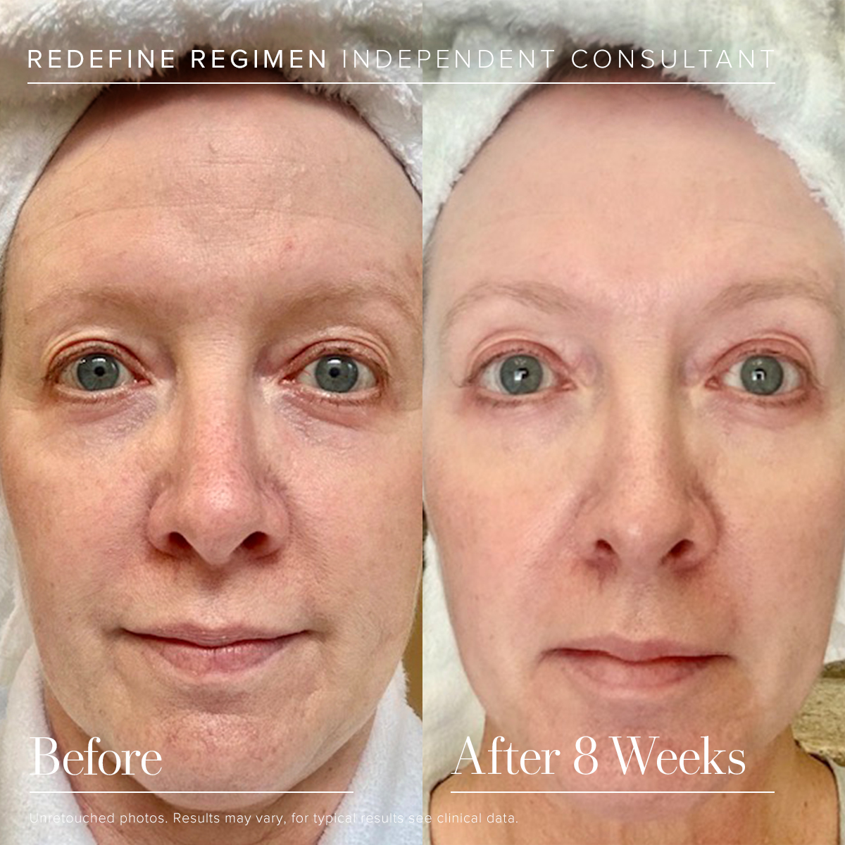 mariewall06's tweet image. RodanFieldsHQ: The results are in. ✔️

The Redefine Regimen works 3x better, 2x faster on wrinkles and now visibly lifts, sculpts + firms as it targets all signs of aging. 

#RodanandFields #RedefineRegimen #AnitAging