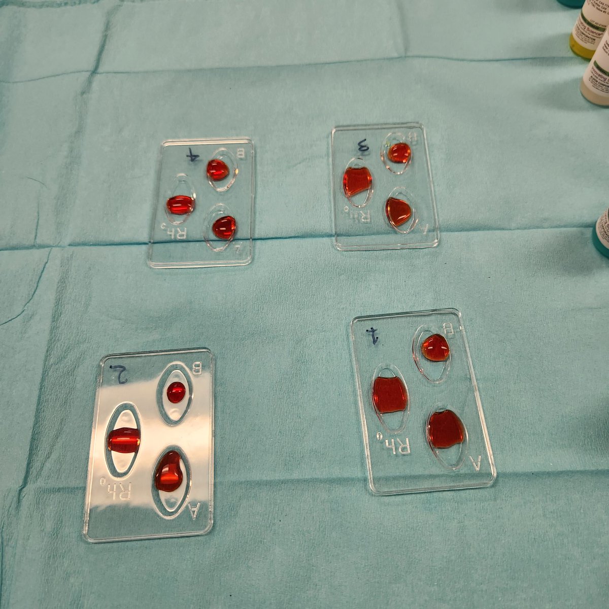 cruzmissy8's tweet image. Wrapping up the lymphatic system with a simulated blood typing lab. Do you know your blood type??
@CanalesC_CTE 
@PISDCareerTech 
#PISDCTE
#PISDCTEMONTH2023
#PISDCTEAllstars
#CMA