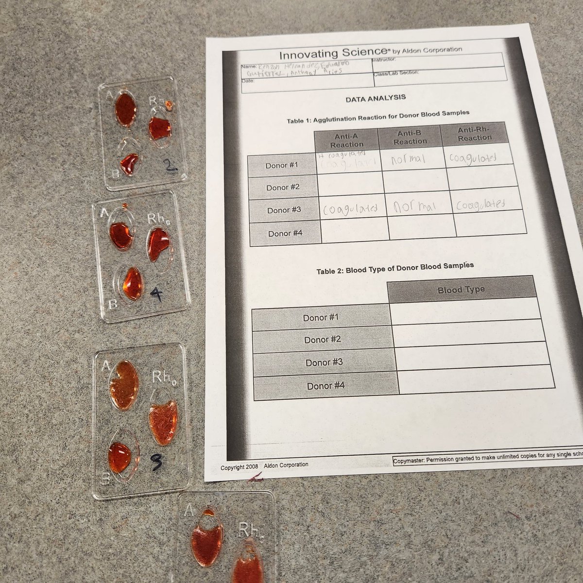 cruzmissy8's tweet image. Wrapping up the lymphatic system with a simulated blood typing lab. Do you know your blood type??
@CanalesC_CTE 
@PISDCareerTech 
#PISDCTE
#PISDCTEMONTH2023
#PISDCTEAllstars
#CMA
