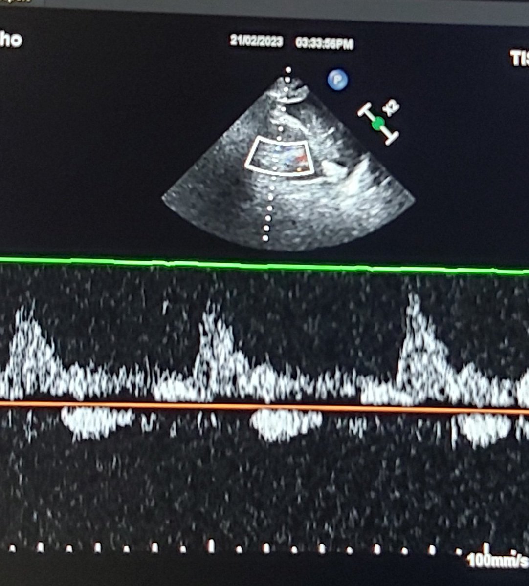Eslam Abu-Naeima tweet media