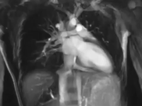 PUREHealthMiami's tweet photo. #HeartMonth is almost over but don’t forget about ❤️ health! When was the last time you had advanced lab testing done to measure heart attack risk? What about a stress test or a cardiac calcium scan? Haven’t done any of it? Talk to your doctor or give us a call 786-227-68 https://t.co/fw8onUTR0X