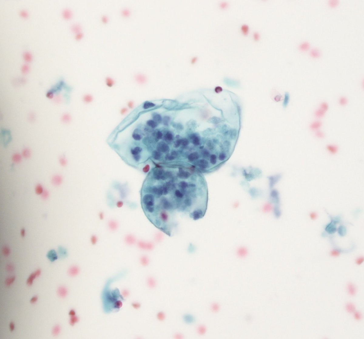 AMubeen_Path's tweet image. Welcome to the Southwest US 
#cytopath #pathbugs #pathboards
