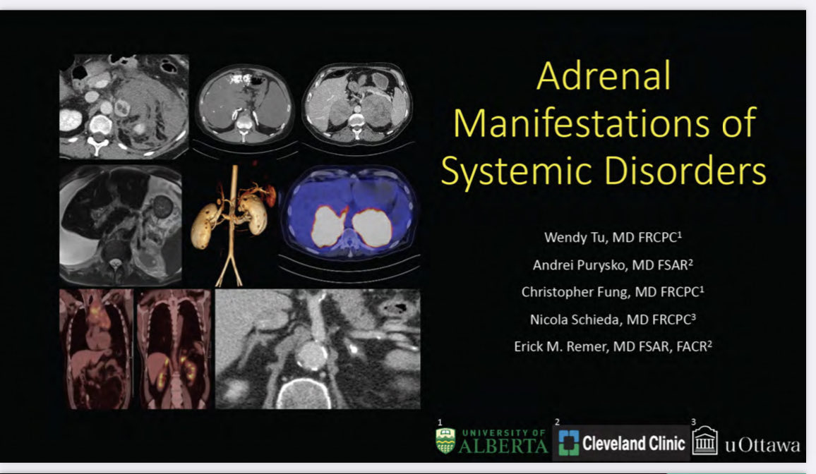 Erick Remer (@erickmremer) on Twitter photo Congratulations <a href="/WendyTuMD/">Wendy Tu, MD</a> for your Cum Laude Award at #SAR23! <a href="/SocietyAbdRad/">Society of Abdominal Radiology | SAR</a> <a href="/adrenaldfp/">SAR_AdrenalDFP</a> <a href="/Purysko/">Andrei Purysko</a> <a href="/NickSchiedaMD/">NickSchieda</a> Congratulations <a href="/WendyTuMD/">Wendy Tu, MD</a> for your Cum Laude Award at #SAR23! <a href="/SocietyAbdRad/">Society of Abdominal Radiology | SAR</a> <a href="/adrenaldfp/">SAR_AdrenalDFP</a> <a href="/Purysko/">Andrei Purysko</a> <a href="/NickSchiedaMD/">NickSchieda</a>