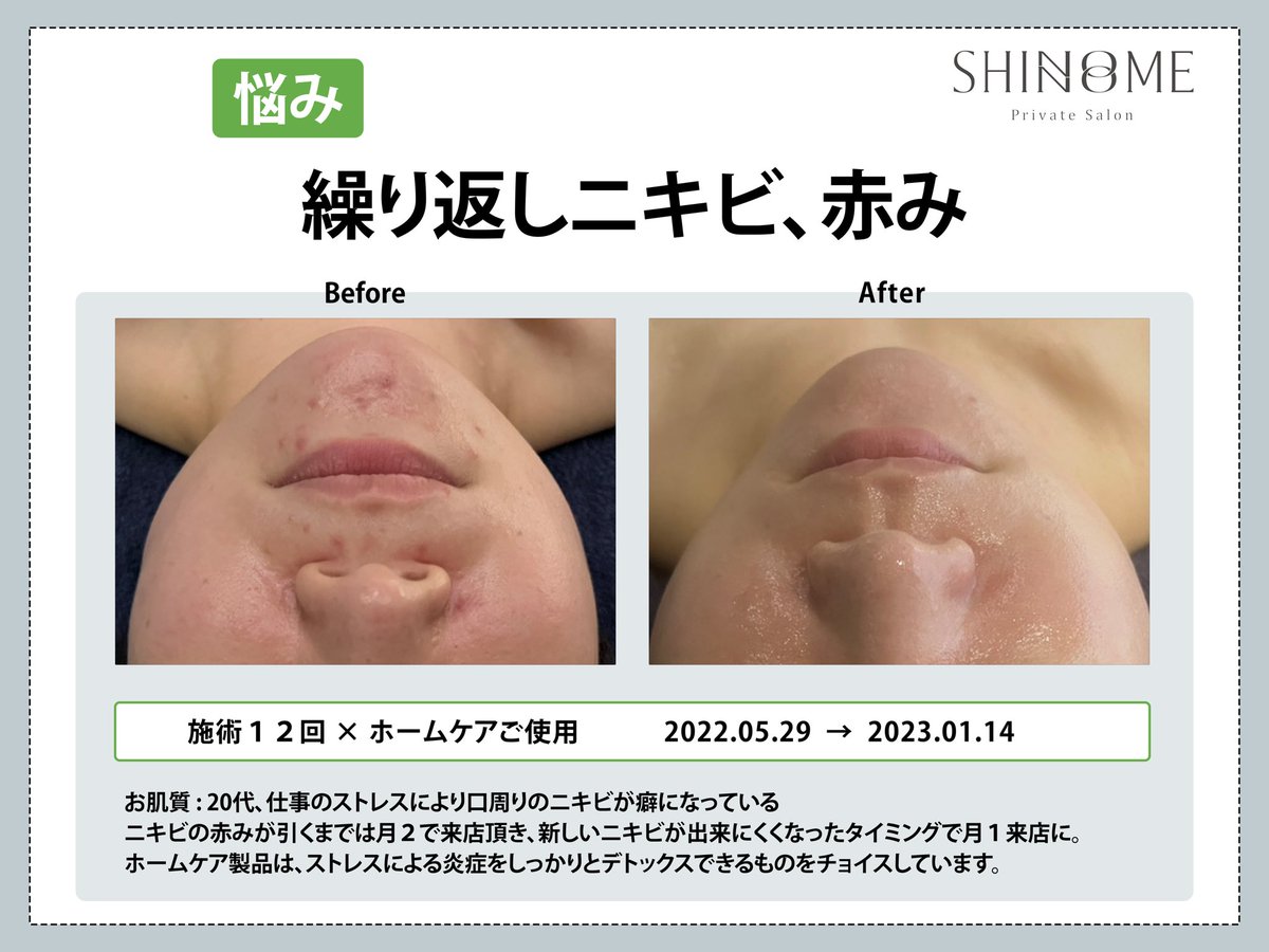 SHINONOME 中目黒 (@shinonome_life) / Posts / X