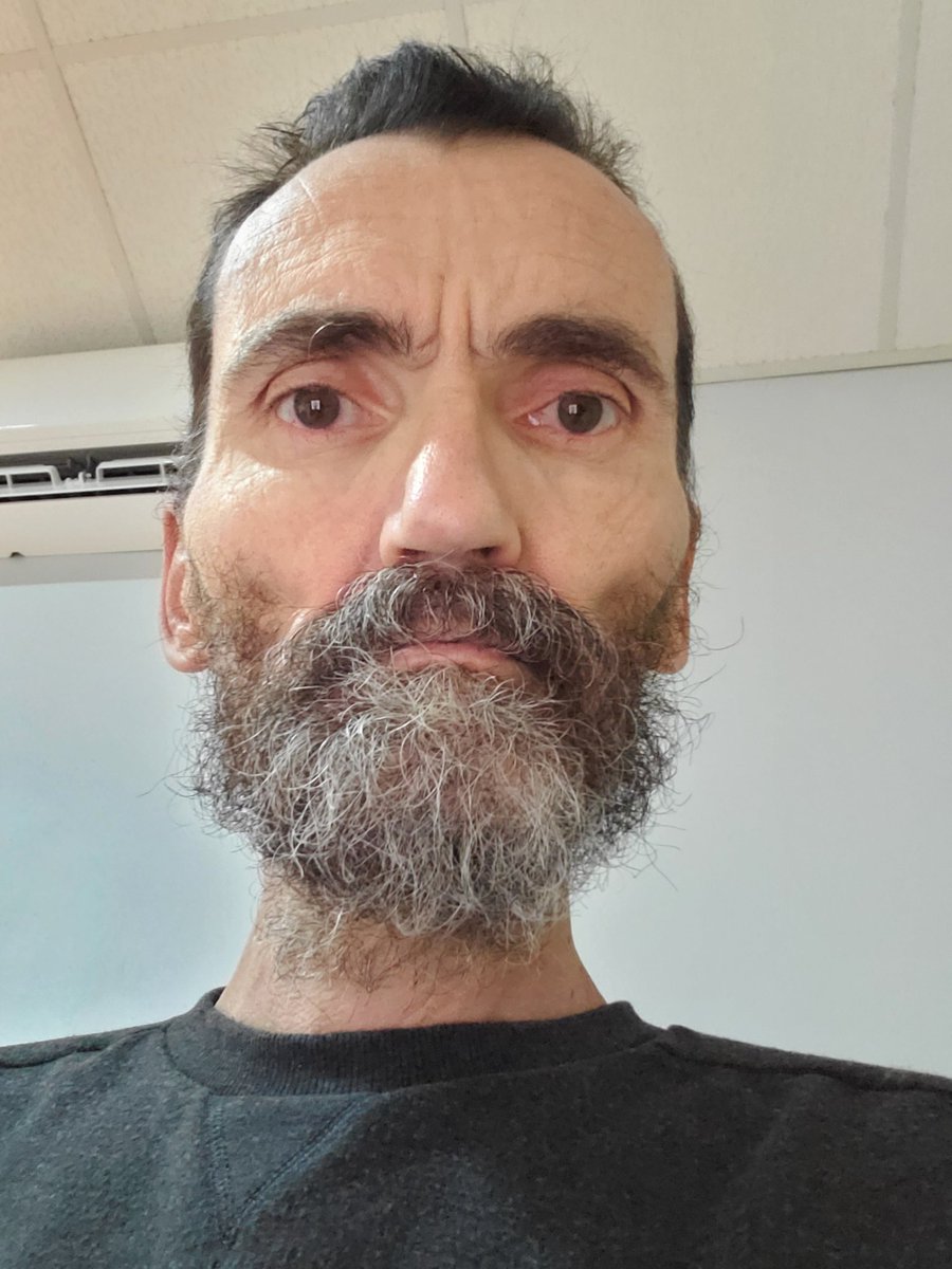 joanyloes's tweet photo. Como se de queda a uno la cara con más de 60 días en Huelga de Hambre; cuatro ingresos hospitalarios para fluoterapiia, no nutricional; y ser tratado peor que un terrorista, criminal y asesino. https://t.co/fi8bK55S3e