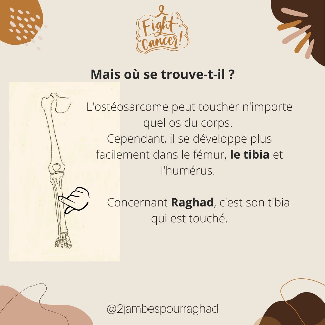 PourRaghad's tweet photo. Depuis le début, on vous parle de l’ostéosarcome ou de la tumeur au tibia de Raghad, voici quelques précisions. 
Nous avons toujours besoin de vous, vos partages sont précieux

#2jambespourraghad #osteosarcoma #fightcancer #cancerdesos #cancerenfant #besoindunechirurgie #charity https://t.co/AzWtOBd1we