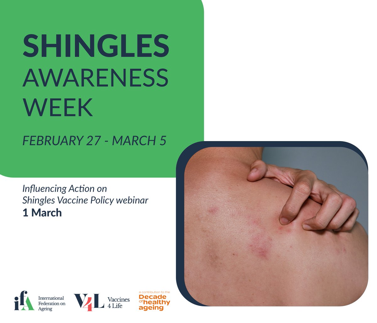 As part of #ShinglesAwarenessWeek, we'll be joining @IFAgeing @vaccines4life tomorrow for their webinar looking at the status of shingles in the EU 🇪🇺

Register here 👇

us06web.zoom.us/webinar/regist…