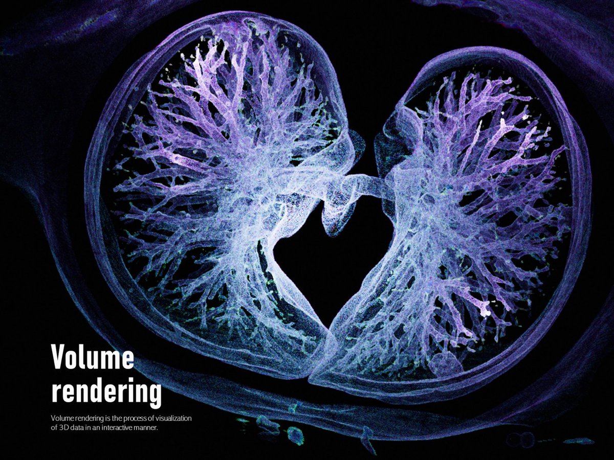 gaogaibaigu's tweet photo. try using volume render to show medical data in different style
#blender #3Danimation #biovisualization #Medical https://t.co/4KrWXlzEOm