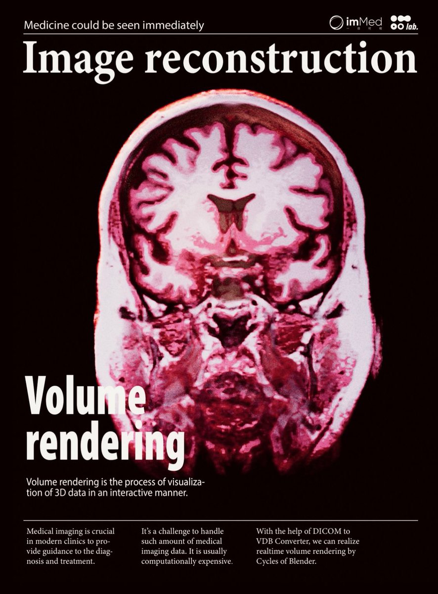 gaogaibaigu's tweet photo. try using volume render to show medical data in different style
#blender #3Danimation #biovisualization #Medical https://t.co/4KrWXlzEOm