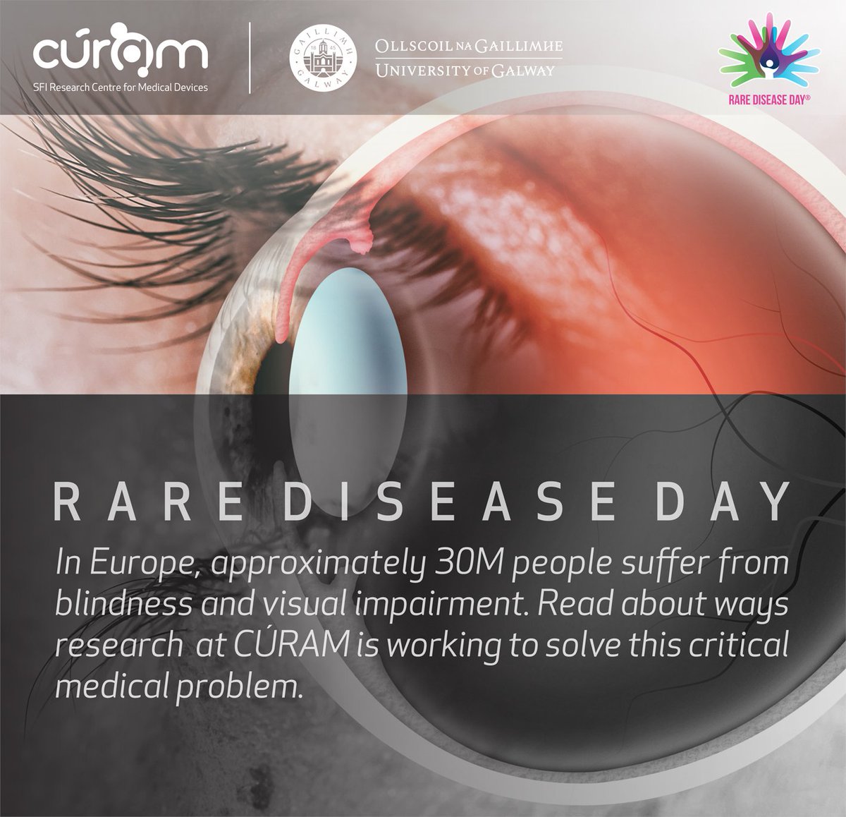 On #RareDiseaseDay2023 we take a look at Rare Eye Diseases (REDs), a major cause of visual impairment and blindness in Europe.

Research by Prof. Thomas Ritter <a href="/ThomasR55937842/">Thomas Ritter 🇩🇪🇪🇺🇮🇪</a> and colleagues aims to find new effective medicines for REDs.

Read more - tinyurl.com/znvtxvck