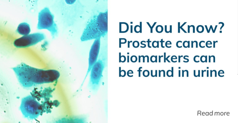 Novosanis's tweet photo. Early detection can signficantly increase chances of survival of #prostatecancer. Did you know urine contains several biomarkers for this cancer type.

Learn more in our white paper - https://t.co/ZgqcJhaIv7

#NationalCancerPreventionMonth https://t.co/qQO1hrKHo7