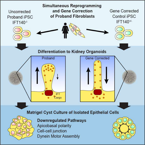 ckd_ce's tweet photo. 8b) @Kidney_Tom utilised kidney #organoids to show that biallelic variants in #IFT140 were associated with short club-like cilia. https://t.co/grpCbad44o