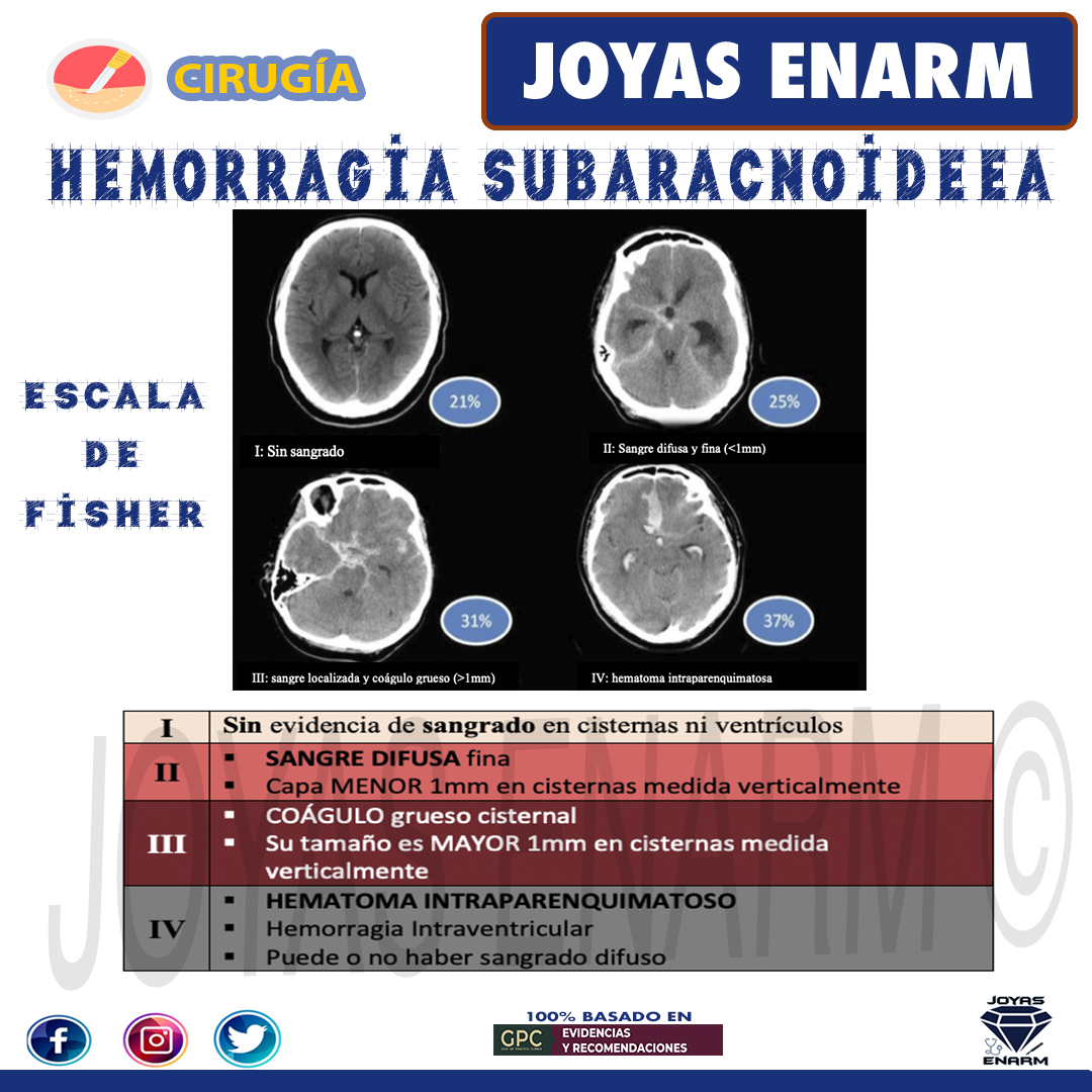 Joyas_ENARM's tweet photo. Hemorragia Subaracnoidea   #ENARM 💎

✅Encuentra el tema completo en: https://t.co/RJsORwfHxi

 Beneficios Exclusivos: https://t.co/Hs6dz9kaLi
#ENARM2023 🏆 https://t.co/lApAJJkVtD