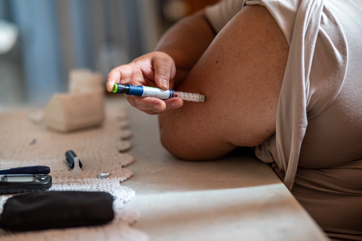 Child obesity is linked to increased risk of developing diabetes in adulthood, both autoimmune forms of diabetes and different forms of type 2 diabetes, a study published in <a href="/DiabetologiaJnl/">Diabetologia</a> reports. Research by <a href="/yuxia_wei/">Yuxia Wei</a> and @sofieaejcarlsson et alt. 
news.ki.se/childhood-obes…