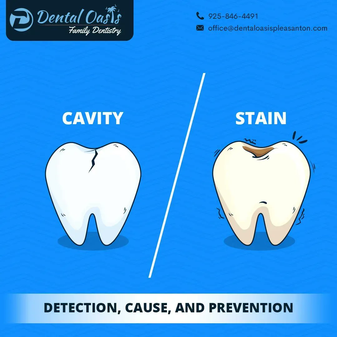 Cavity vs Stain: Detection, Cause, and Prevention!

buff.ly/3lHEvrh 

#DentalTips #ToothStains #ToothCavity #CavityTreatment #DentalTreatment