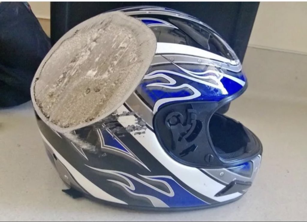 OGdukeneurosurg's tweet image. Helmet injury is so much better than skull and brain damage. credit med.bit