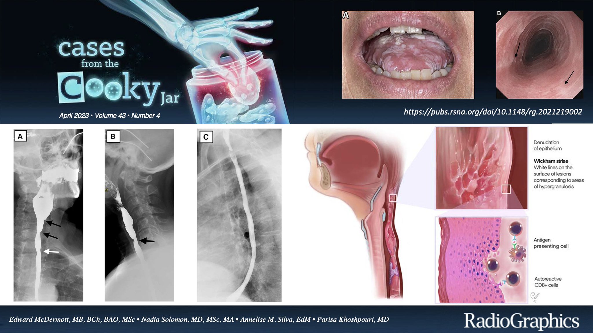 Cases From the Cooky Jar on Twitter "73 yo woman who presented with