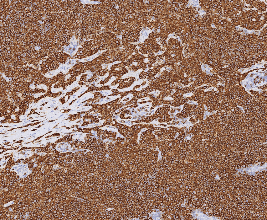 Spotlight Pathology (@spotlight_path) on Twitter photo We’re a spinout from <a href="/OfficialUoM/">The University of Manchester</a> and so we are a #HealthcareStartup with close ties to the innovations happening across the institution.
Take a look at the link to find out more about us, and get in touch if you’d like to know more: spotlightpathology.com We’re a spinout from <a href="/OfficialUoM/">The University of Manchester</a> and so we are a #HealthcareStartup with close ties to the innovations happening across the institution.
Take a look at the link to find out more about us, and get in touch if you’d like to know more: spotlightpathology.com