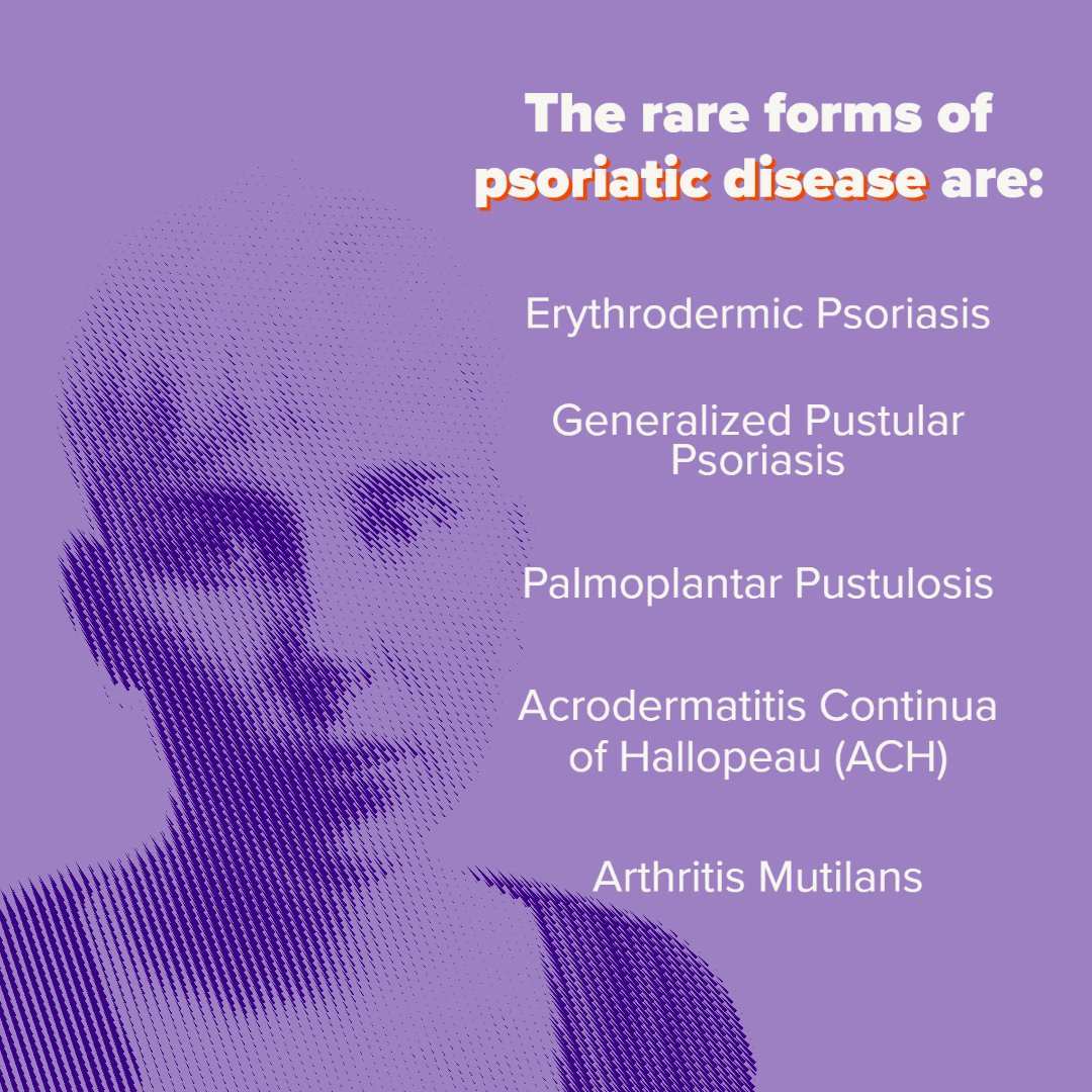 PsoriasisIFPA's tweet image. Often the most rare forms of psoriatic disease are also the most severe. Access to care and information is even more important for people living with these diseases. #RareDiseaseDay #RareIsMany #GPP #SeeRare