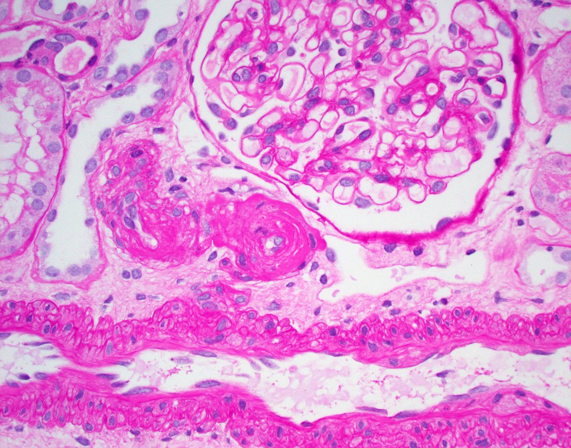 JZRenalPath tweet picture