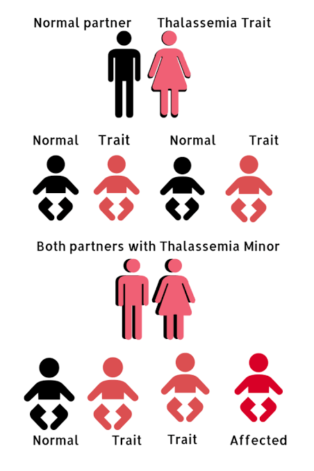 FardeenFazal440's tweet photo. Possibilities of transfer of Thalassemia disease from parent to offsprings
@qalbwf
#wewantthalassemiafreepakistan https://t.co/b4UX7pwPde