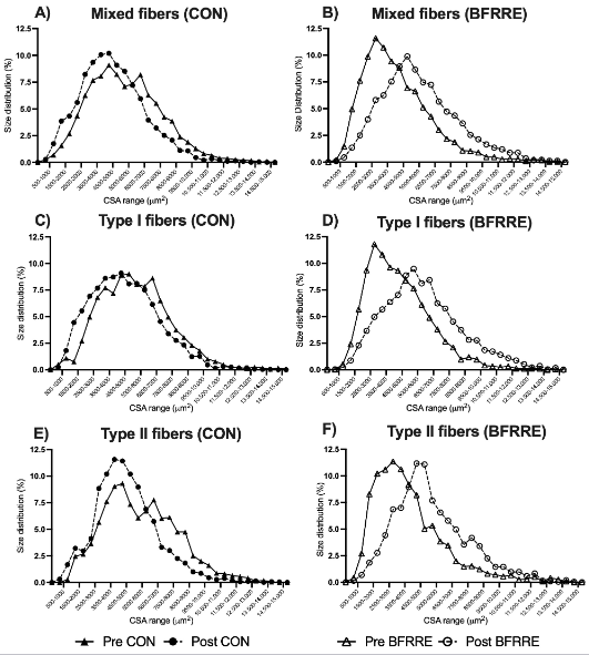 Dr. Myohead (@drmyohead) on Twitter photo Low-load blood flow-restricted resistance exercise produce fiber type-independent hypertrophy and improves muscle functional capacity in older individuals
From <a href="/JakobWang/">Jakob Wang</a> <a href="/GerritvanHall/">Gerrit van Hall</a> <a href="/JakobAgergaard/">Jakob Agergaard</a> <a href="/JeanFarup/">Jean Farup</a> <a href="/VissingKristian/">Kristian Vissing</a> et al
doi.org/10.1152/japplp… Low-load blood flow-restricted resistance exercise produce fiber type-independent hypertrophy and improves muscle functional capacity in older individuals
From <a href="/JakobWang/">Jakob Wang</a> <a href="/GerritvanHall/">Gerrit van Hall</a> <a href="/JakobAgergaard/">Jakob Agergaard</a> <a href="/JeanFarup/">Jean Farup</a> <a href="/VissingKristian/">Kristian Vissing</a> et al
doi.org/10.1152/japplp…