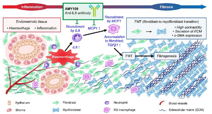 ScienceTM's tweet photo. Researchers identify #Interleukin8 as a driver of inflammation and lesions in #endometriosis—and present an anti-IL-8 antibody that can shrink lesions and fibrotic adhesions in a large animal model. #ReproductiveHealth @chugai_cc https://t.co/881UW7xtIG https://t.co/iFQtU6z1ic