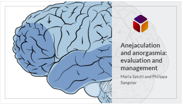 bjuiknowledge's tweet photo. Calling all #urologists looking to progress their #CPD / #CME and refresh their #SexualHealth knowledge.
👉 Access ‘#Anejaculation and #Anorgasmia - evaluation and management’ by @mariasatchi and @Pippa_Sangster.
https://t.co/2FlZ9mqZW4 https://t.co/sPCo8ow2i7