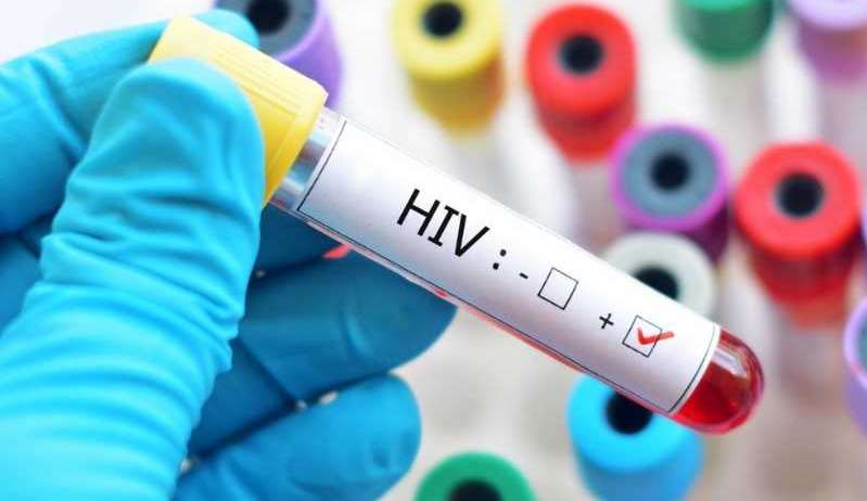 1clickMg's tweet photo. Brasil possui mais de um milhão de pessoas portadoras do vírus HIV, diz Ministério da Saúde
#AIDS #HIV #saúde #SíndromedaImunodeficiênciaAdquirida #vírusHIV

https://t.co/7JWXv5Dw7g https://t.co/NtDj5MLvoV