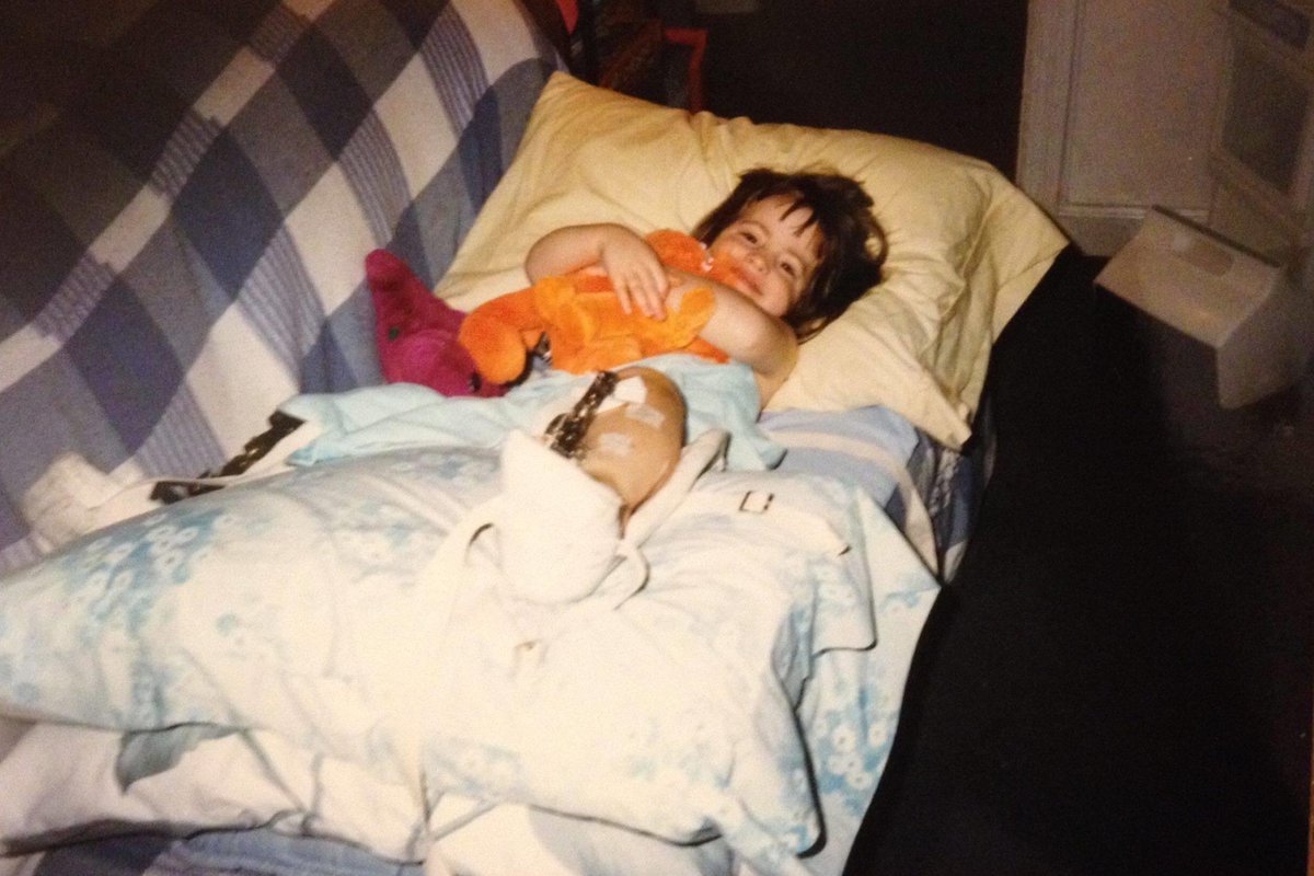 ShanStratton's tweet photo. Happy Rare Disease Day! I’m living with X-linked hypophosphatemia. XLH affects 1 in 20,000 people &amp; may lead to bone abnormalities &amp; defects that may impair mobility, including bone fractures, hearing loss, ligament &amp; bone pains. #xlh #RareDisease #zebra #RareDiseaseDay https://t.co/7A9OuW9Vj2