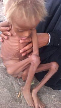 Yemen remains one of the worst humanitarian crises in the world, with nearly 3/4 of the population in need of humanitarian aid and protection. 

UNHCR calls on the international community to stand by the people of Yemen. 

Donate now at
gogetfunding.com/emergency-appe…