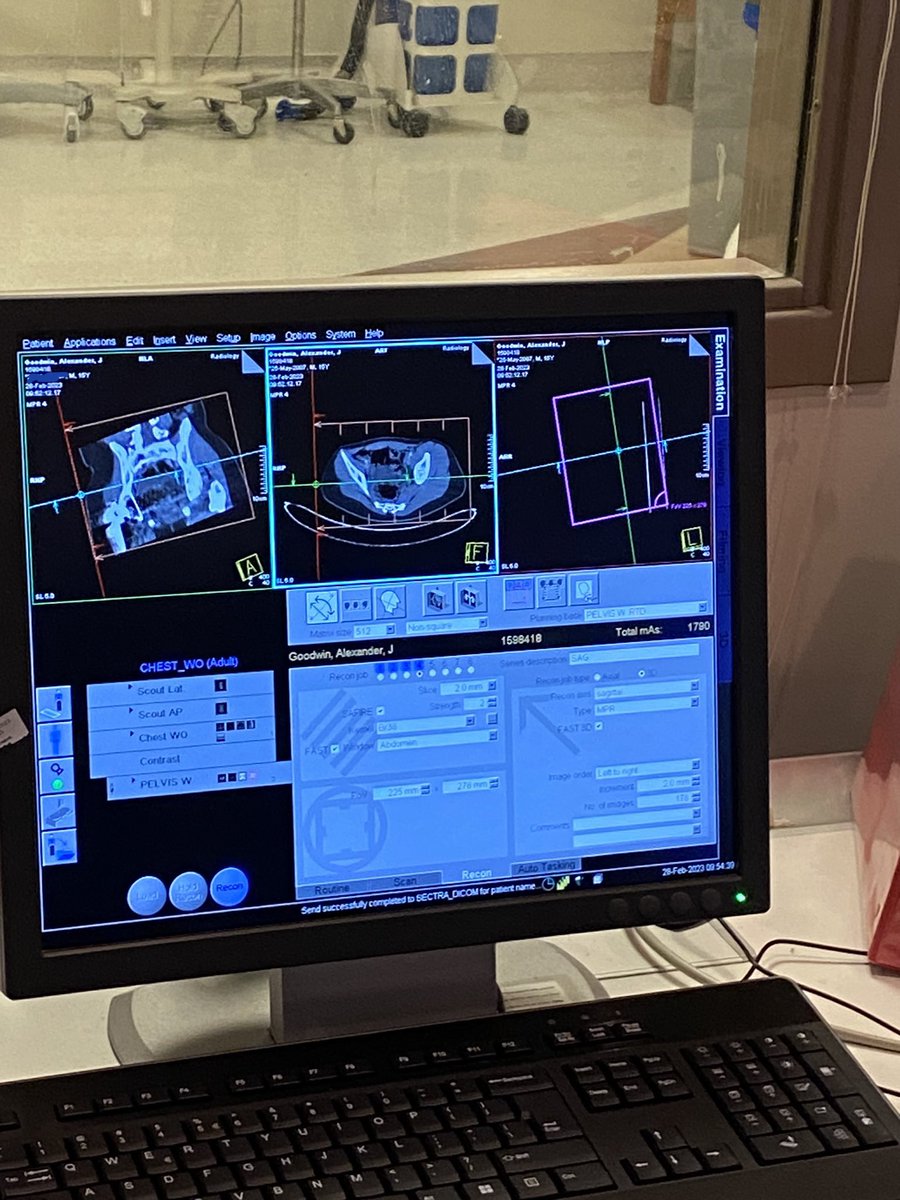 alexs_journey's tweet image. Hi! It’s Alex! More scans and checks at @KUHospital today in the company of @KUHospitalNews who are marking my return with a documentary. CT scan in radiology and some lab work.  💪🏻🦿 #AlexandersJourney #CancerRehab #KUHospital #ChildhoodCancer #DumSpiroSpero