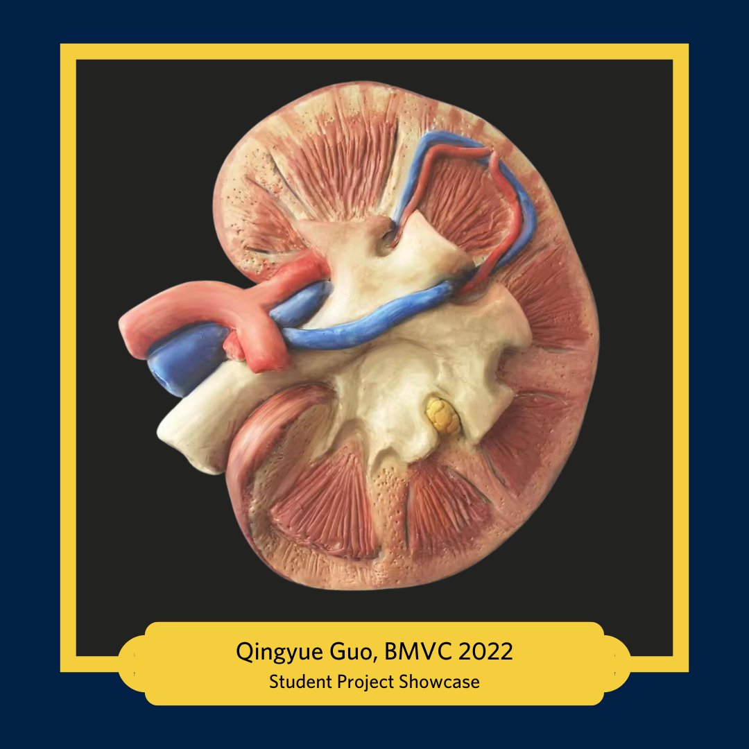 UBCExtended's tweet photo. Can you believe this is made of clay? Our BMVC student, Qingyue Guo, sculpted and painted this kidney for a project for the Human Structure and Function course.
#ArtandScience #Kidney #AnatomyArt #SciComm #BiomedicalVisualization #Communication #VisualforScience https://t.co/OB98DCgH3H