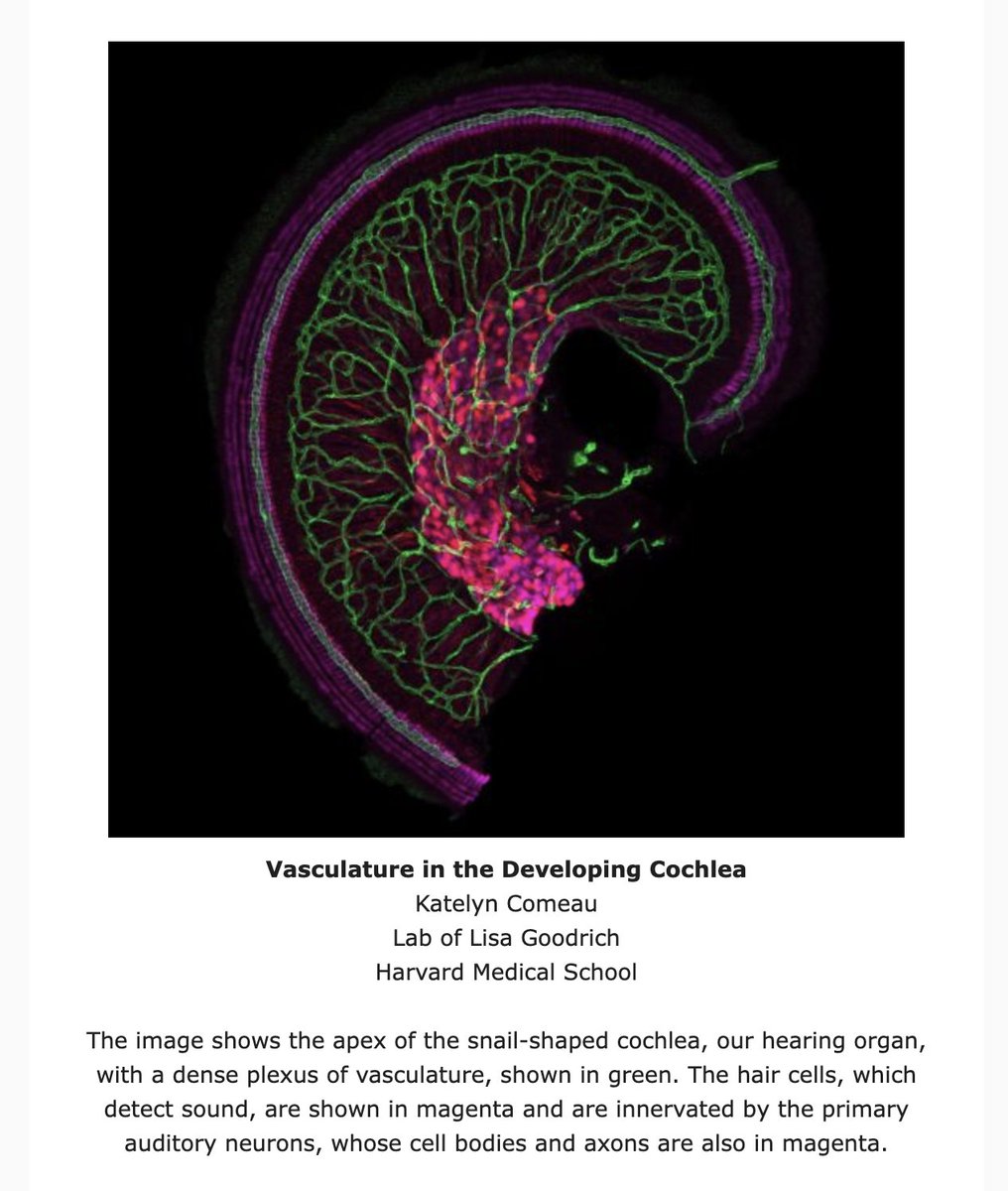 Joy A. Franco, PhD (@engineering_joy) on Twitter photo Big congrats to my awesome Goodrich Lab mate <a href="/Katelyn_Comeau/">Katelyn Comeau Boulanger</a> for her win!
And in case you've never thought about the blood supply to the sensory epithelium of the cochlea, Katelyn's work will likely give you some inspiration to pause Big congrats to my awesome Goodrich Lab mate <a href="/Katelyn_Comeau/">Katelyn Comeau Boulanger</a> for her win!
And in case you've never thought about the blood supply to the sensory epithelium of the cochlea, Katelyn's work will likely give you some inspiration to pause