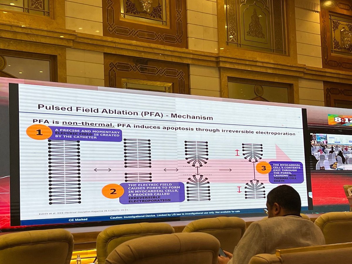 It was great to attend Gulf arrhythmia conference #GAC2023 great organizing and very productive workshops