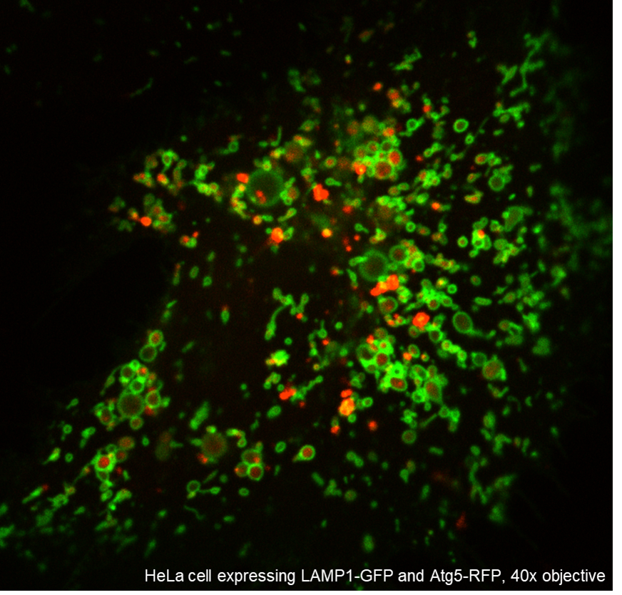 nunoraimundo's tweet photo. Do you like organelles? Curious about mitochondria? Fascinated with lysosomes? Interested in ER, peroxisomes? Maybe a little nucleus?

Then why study just one?!

We are looking for a postdoctoral scientist to work on our organelle crosstalk projects. DM for info. https://t.co/jYodKoaw0p