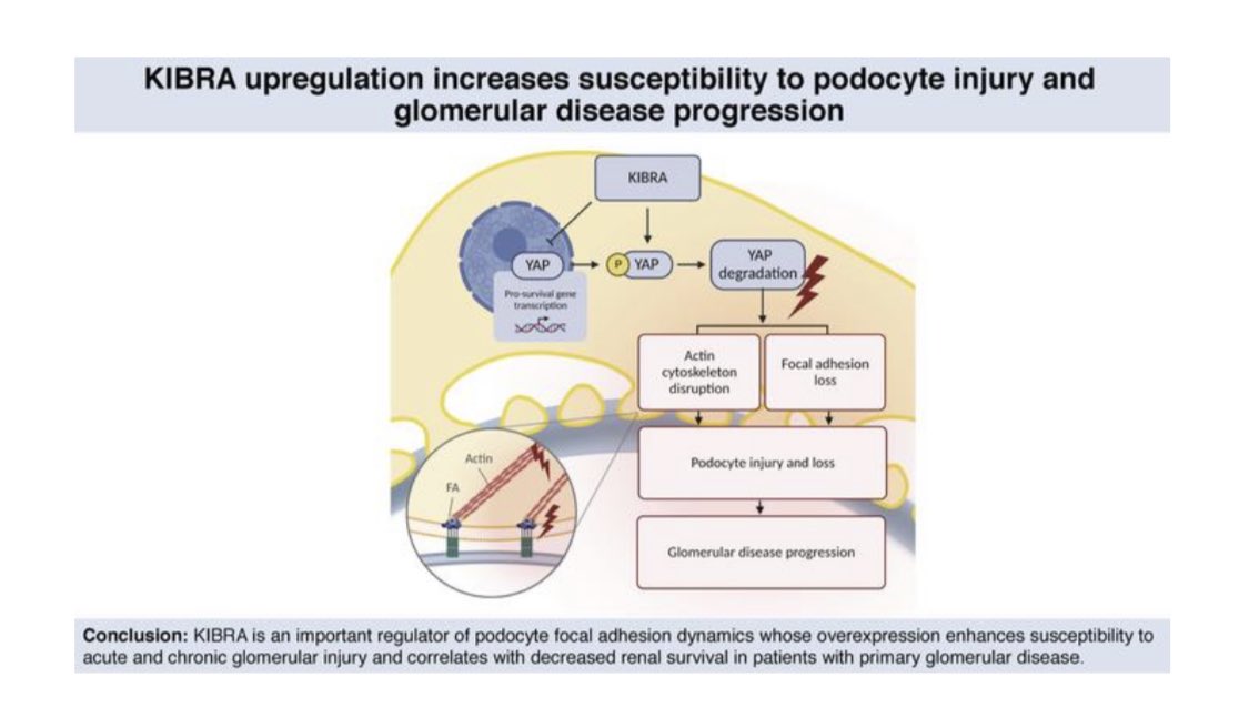 “KIBRA upregulation increases susceptibility to glomerular injury &amp; correlates with #kidney function decline”

insight.jci.org/articles/view/…

Dr. Kristin Meliambro <a href="/marinadecos/">Marina de Cos</a> <a href="/CijiangHe/">John Cijiang He</a> <a href="/kirkcampbell/">Kirk Campbell</a> <a href="/DOMSinaiNYC/">Mount Sinai Department of Medicine</a> <a href="/JCI_insight/">JCI insight</a> 

#Nephrology